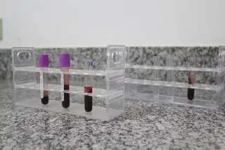 Apenas uma pequena quantidade de sangue é coletada para o teste  (Foto: Decom)