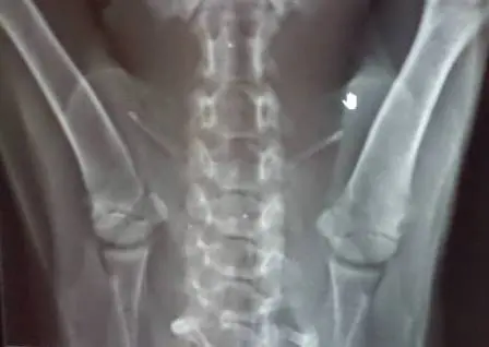 A radiografia que mostra a lesão na cervical. (Foto: Arquivo pessoal)