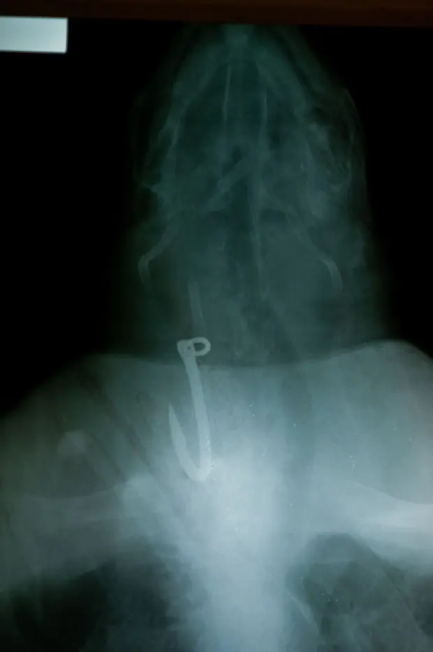 Tartaruga passou por uma cirurgia para a retirada de anzol de seu esôfago (Foto: José Cabezas/AFP)